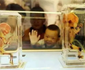 人体奥秘展厅,人体奥秘探索之旅